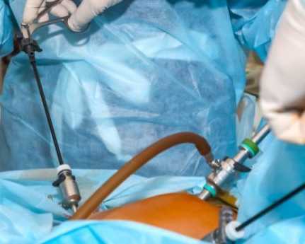 best-appendix-surgeon-in-varanasi-for-safe-recovery-care