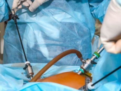 best-appendix-surgeon-in-varanasi-for-safe-recovery-care
