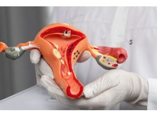 dr-manish-singhal-best-cervical-cancer-doctor-delhi-small-0