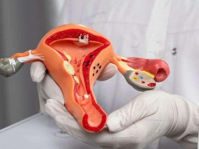 dr-manish-singhal-best-cervical-cancer-doctor-delhi