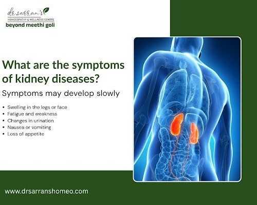 kidney-stone-care-with-homeopathy-in-juhu