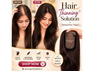 instant-hair-thinning-solution-for-women-small-0