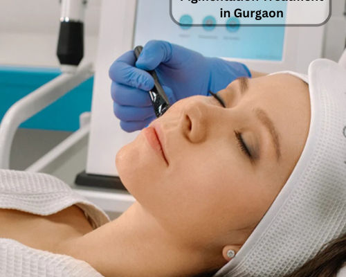 pigmentation-treatment-in-gurgaon-for-clear-even-skin