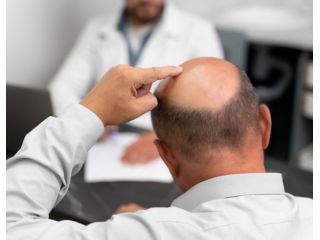 effective-hair-transplant-solutions-in-varanasi-small-0