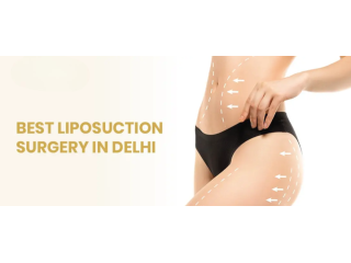 advanced-liposuction-surgery-in-delhi-langersculpt-small-0
