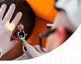 rhinoplasty-specialist-in-kozhikode