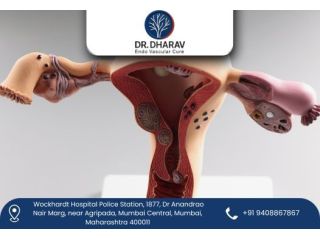uterine-fibroid-embolization-by-dr-dharav-kheradia-small-0