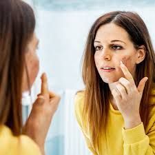 best-dermatologist-in-delhi-citrine-clinic-big-0