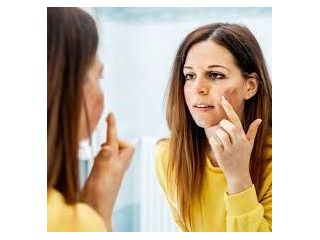 best-dermatologist-in-delhi-citrine-clinic-small-0