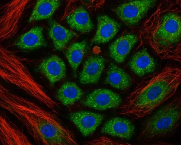 high-resolution-laser-confocal-microscopes-for-3d-imaging
