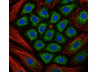 high-resolution-laser-confocal-microscopes-for-3d-imaging-small-0