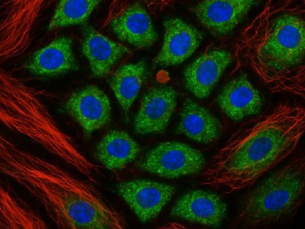high-resolution-laser-confocal-microscopes-for-3d-imaging