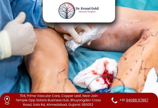 restore-healthy-blood-flow-with-expert-vascular-care-big-0