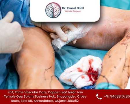 restore-healthy-blood-flow-with-expert-vascular-care