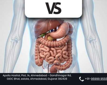 advanced-gastrointestinal-surgery-with-robotic-precision