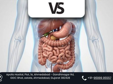 advanced-gastrointestinal-surgery-with-robotic-precision