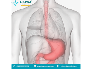 stomach-cancer-treatment-in-ahmedabad-airavat-cancer-care-small-0