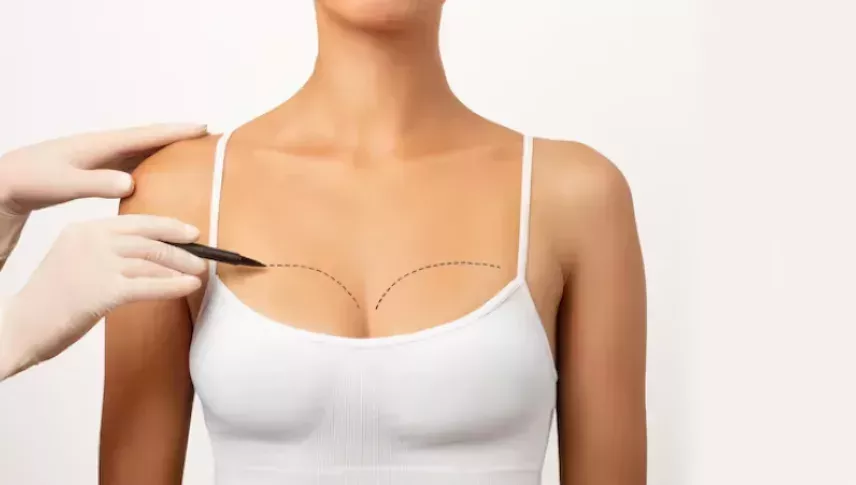 breast-lift-surgery-in-gurgaon-with-dr-shilpi-bhadani-big-0