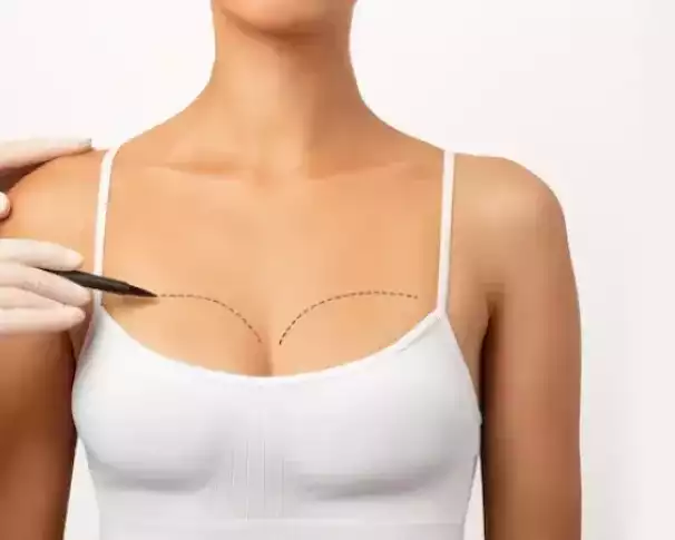 breast-lift-surgery-in-gurgaon-with-dr-shilpi-bhadani