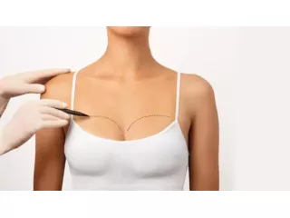 breast-lift-surgery-in-gurgaon-with-dr-shilpi-bhadani-small-0