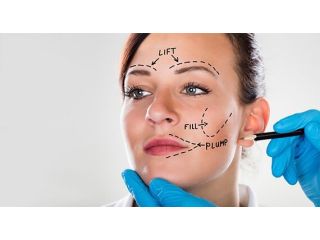 facelift-surgery-cost-in-delhi-ncr-dr-rajat-gupta-small-0