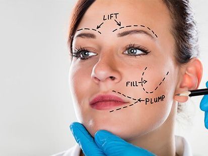 facelift-surgery-cost-in-delhi-ncr-dr-rajat-gupta