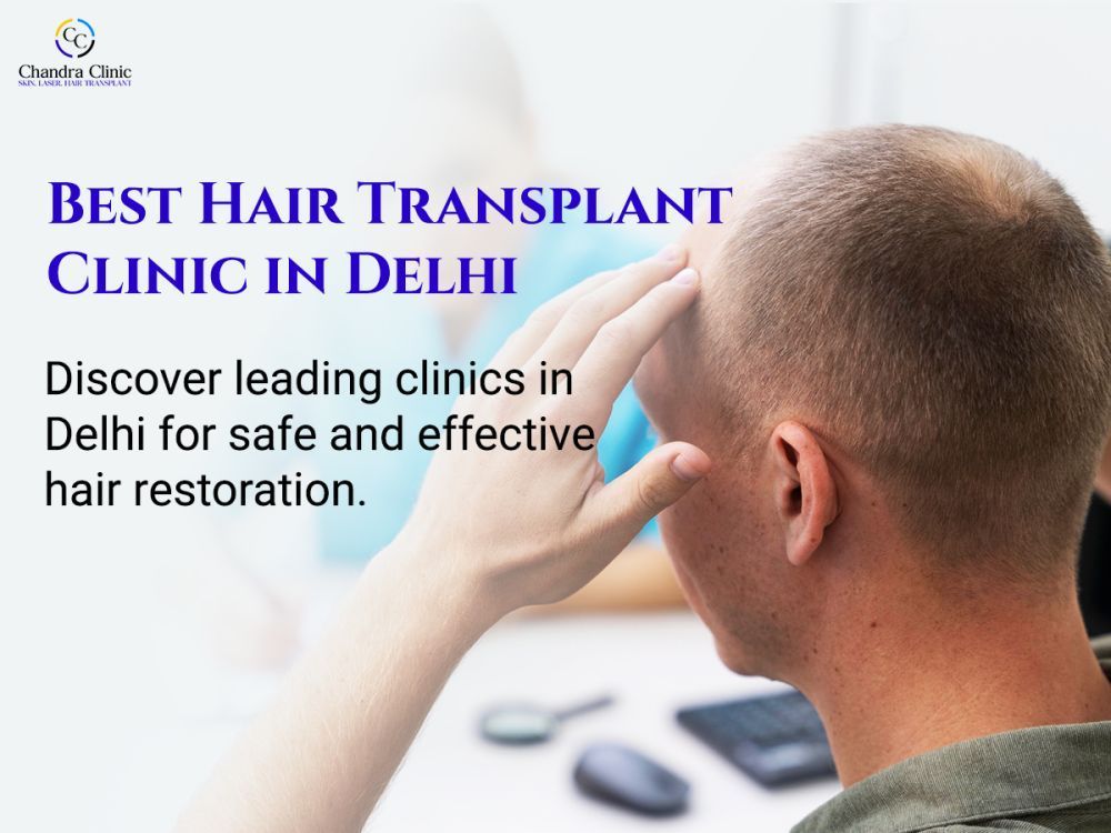 best-hair-transplant-clinic-in-delhi-for-permanent-results-big-0