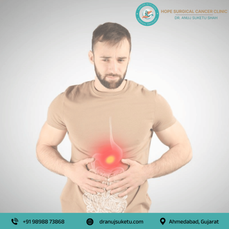 stomach-cancer-specialist-in-ahmedabad-dr-anuj-suketu-shah-big-0