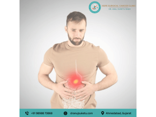 stomach-cancer-specialist-in-ahmedabad-dr-anuj-suketu-shah-small-0