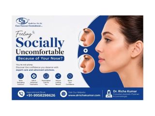 feeling-socially-uncomfortable-because-of-your-nose-small-0