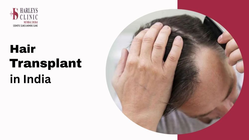 get-best-hair-transplant-cost-in-india-with-experts-big-0