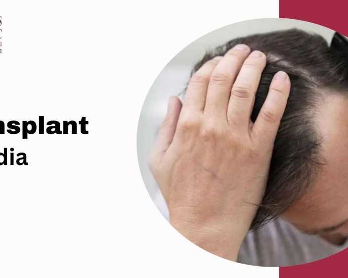 get-best-hair-transplant-cost-in-india-with-experts