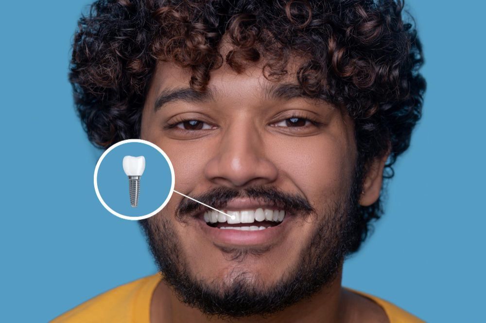 dental-implants-in-indirapuram-white-dental-healthcare-big-0
