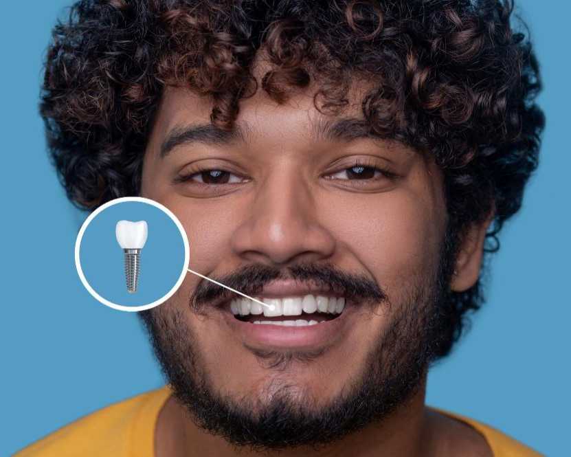 dental-implants-in-indirapuram-white-dental-healthcare