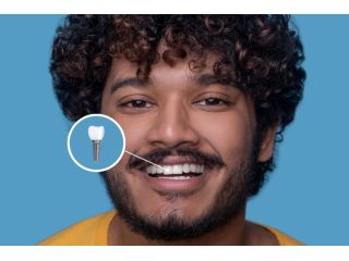 dental-implants-in-indirapuram-white-dental-healthcare-small-0