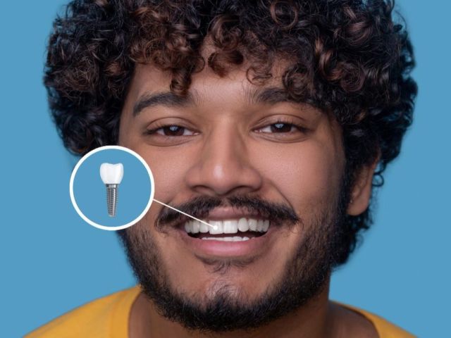 dental-implants-in-indirapuram-white-dental-healthcare