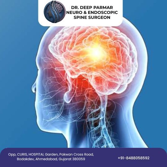 advanced-brain-hemorrhage-treatment-in-ahmedabad-big-0