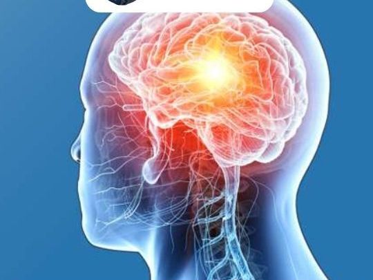 advanced-brain-hemorrhage-treatment-in-ahmedabad