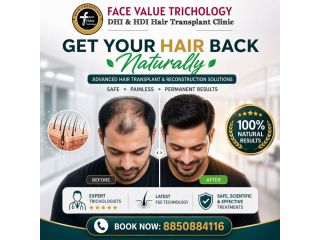 get-your-hair-back-naturally-advanced-hair-transplant-in-chennai-small-0