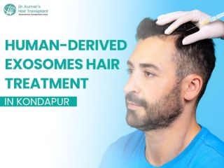 best-exosome-hair-treatment-in-kondapur-for-hair-fall-control-small-0