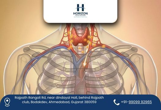renowned-thyroid-cancer-surgeon-in-ahmedabad-big-0