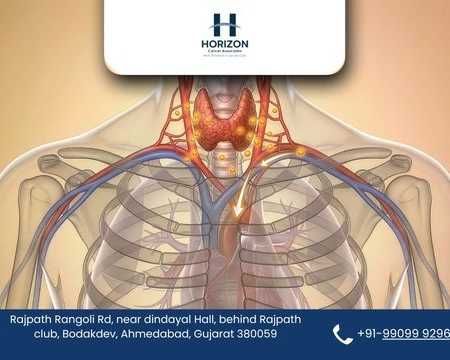 renowned-thyroid-cancer-surgeon-in-ahmedabad