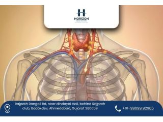 renowned-thyroid-cancer-surgeon-in-ahmedabad-small-0