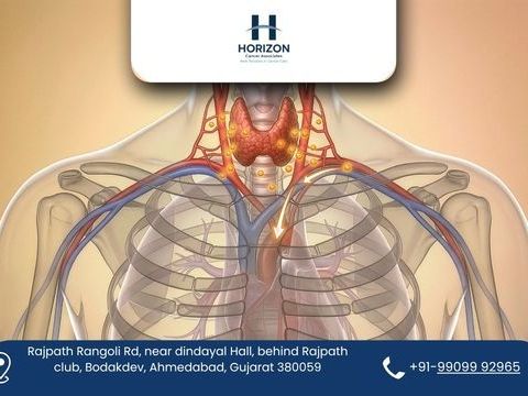 renowned-thyroid-cancer-surgeon-in-ahmedabad