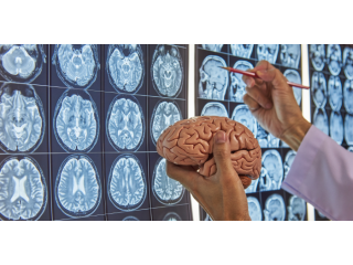 expert-brain-spine-care-by-the-best-neurosurgeon-in-mumbai-small-0