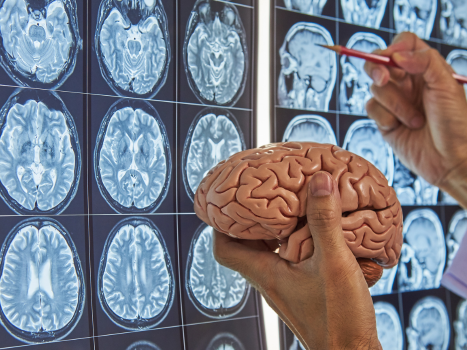 expert-brain-spine-care-by-the-best-neurosurgeon-in-mumbai