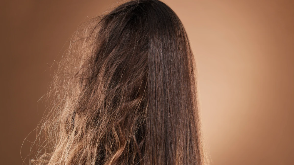 frizzy-hair-guide-causes-fixes-expert-tips-big-0