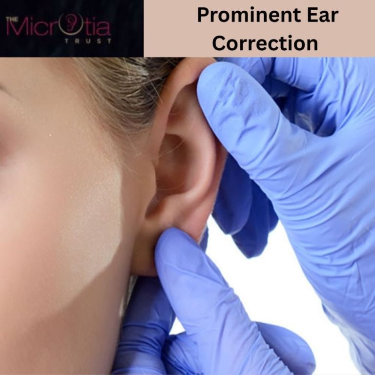 safe-and-effective-prominent-ear-correction-in-mumbai-big-0