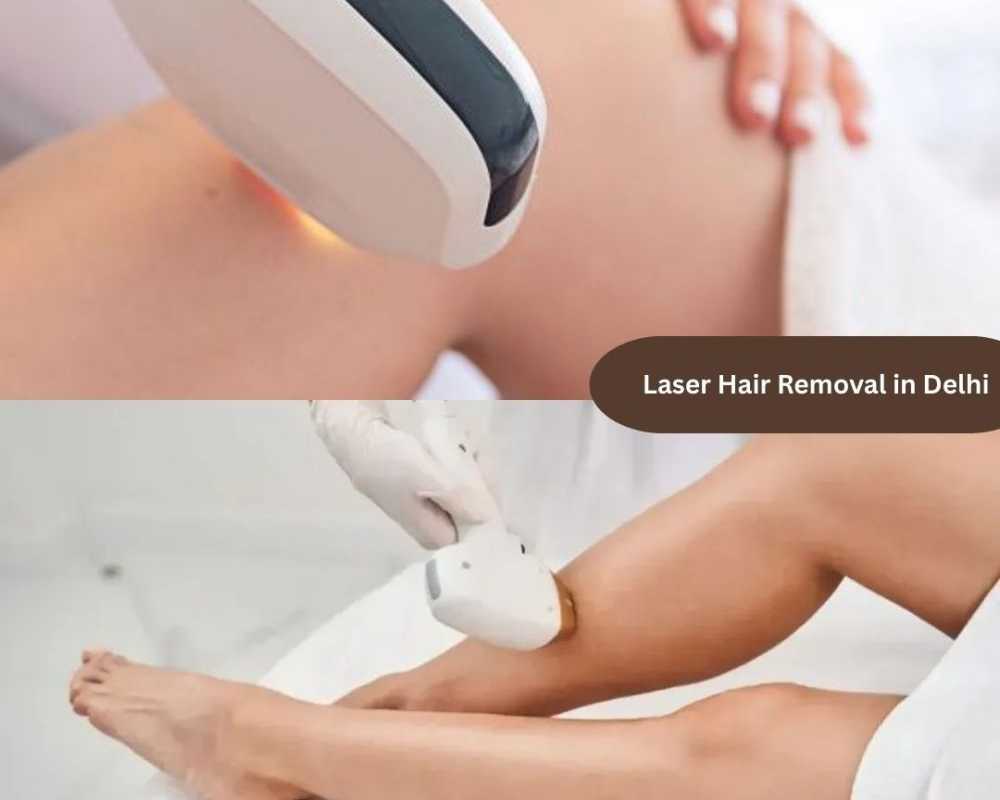 laser-hair-removal-cost-in-delhi-explained-by-dr-rohit-batra