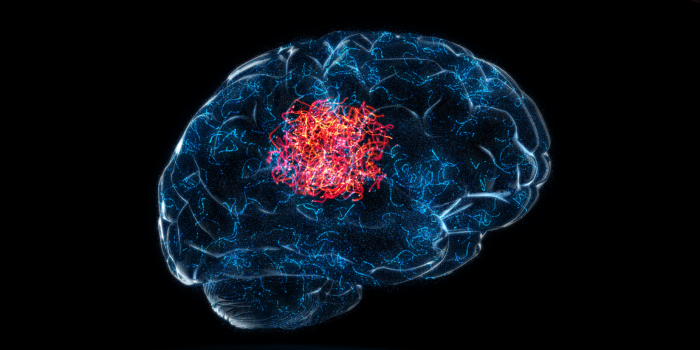 expert-surgical-support-for-complex-brain-tumor-conditions-big-0